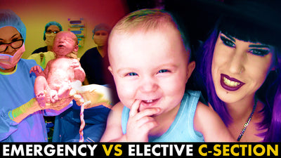 LIVE C-section footage + comparing Emergency Vs Elective cesarean | Part 1